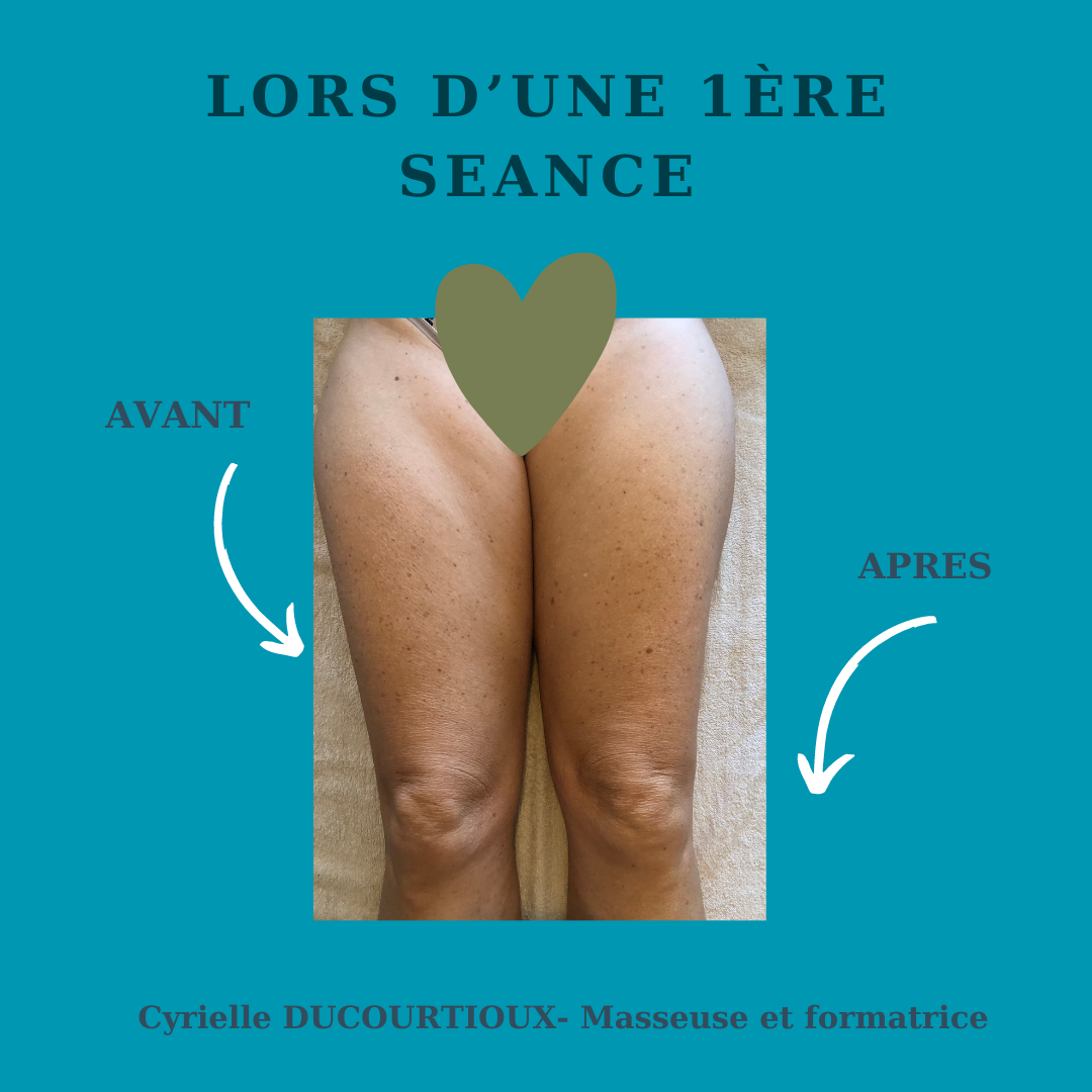 Massage minceur et remodelant par madérothérapie à proximité de Lyon.